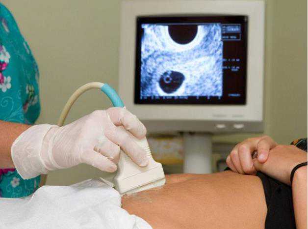 广州试管代生服务机构 广州有哪些医院可以做第三代试管婴儿? ‘孕囊和胚芽看